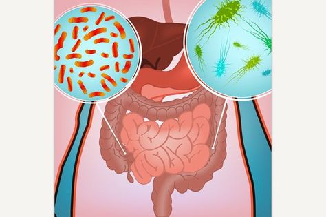 Intestinal Infection Image. Medical Infographic. $3.00 Human Microbiome, Headache Causes, Gastrointestinal Tract, Gut Flora, Musculoskeletal System, Wellness Resources, Gi Tract, Gut Bacteria, Nerd Love