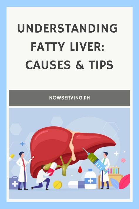 Illustration of medical professionals with an oversized liver, highlighting the theme of understanding fatty liver causes and tips. Quadrants Of The Abdomen, Enlarged Liver, Kidney Detox, Alcohol Consumption, Abdominal Discomfort, Liver Function, Liver Detoxification, Liver Support, Lack Of Energy