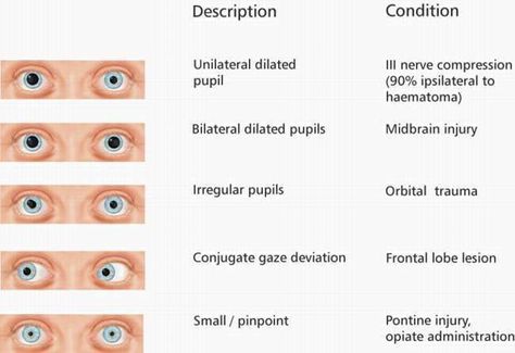 Emt Study, Nursing Study Tips, Nursing Information, Nursing Cheat, Nursing Fun, Nursing Assessment, Critical Care Nursing, Nursing School Studying, Nursing School Tips