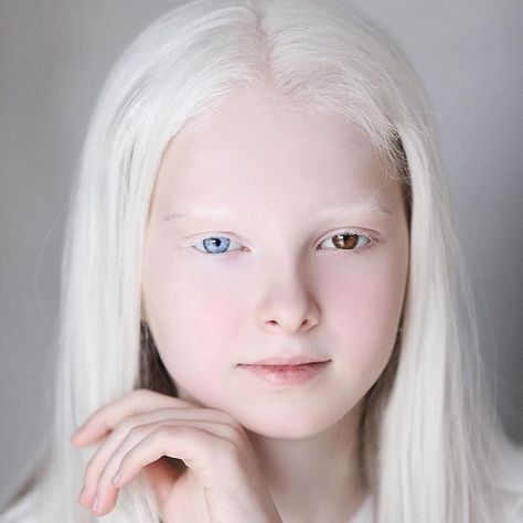 Albino Girl, 동화 삽화, White Blonde Hair, Photographie Portrait Inspiration, White Blonde, Doll Painting, Shooting Photo, Ethereal Beauty, White Hair