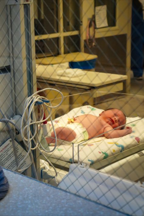 Why do babies get jaundice? In this article, you will learn type of jaundice babies usually get, the causes and solutions. Do Baby, Bassinet, Toddler Bed, Quick Saves