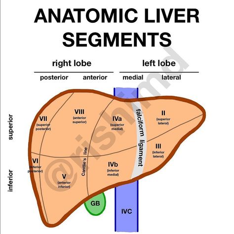 Rishi Kumar, MD, FACC | RK.md on Instagram: “The Couinaud classification system divides the liver into eight, functionally independent segments each with a center consisting of portal…” Diagnostic Medical Sonography Student, Sonography Student, Diagnostic Medical Sonography, Interventional Radiology, Medicine Notes, Nurse Rock, Xray Tech, The Liver, Medical Knowledge