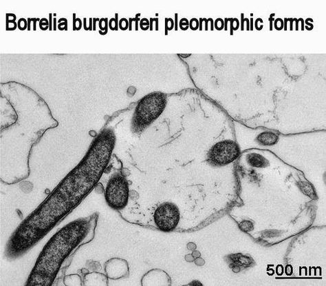 Borrelia burgdorferi pleomorphic forms Borrelia Burgdorferi, Clinical Laboratory, Lab Values, Med Tech, Biomedical Science, Medical Laboratory, Medical Technology, Microbiology, Dermatology