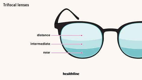 Trifocal Lenses: Uses, Benefits, Costs, and Comparison to Bifocals Multifocal Lenses, Dry Eye Symptoms, Eye Sight, Soft Contact Lenses, Soft Lens, Types Of Glasses, Blurry Vision, Bifocal Glasses, Bifocal Lenses