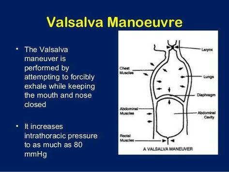 Valsalva maneuver Anatomy Infographic, Nursing Facts, Study Tricks, Valsalva Maneuver, Med School Study, Medical Notes, Fluid And Electrolytes, Emergency Nursing, Anatomy Physiology