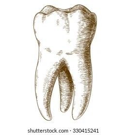 Tooth Drawing, Teeth Tattoo, Teeth Drawing, Tooth Tattoo, Wisdom Tooth, Palm Tattoos, Dental Technician, Wisdom Teeth Removal, Ct Scan