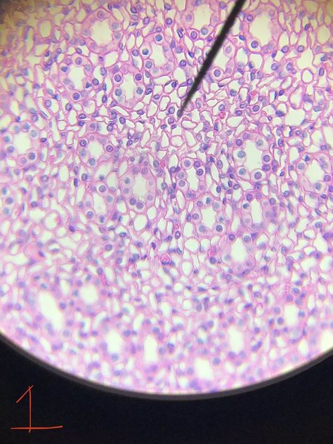 Simple cuboidal epithelium lines the follicles of the thyroid gland, covers the ovaries, lines the kidney tubules, and ducts of certain glands. Simple cuboidal epithelium is good at protecting underlying tissues and diffusion, but isn't as good as columnar or squamous epithelium Glandular Epithelium, Types Of Epithelial Tissue, Loose Connective Tissue Histology, Insufficient Glandular Tissue, Esophagus Histology, Thyroid Gland, Sprinkles, Candy