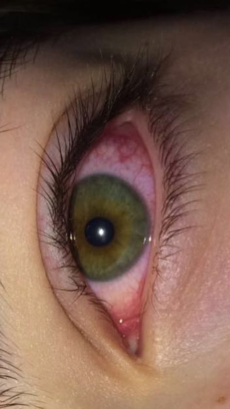 Crying Eyes, Smoked Eyes, Eye Photography, Aesthetic Eyes, Instagram Ideas Photography, Summer Friends, Puff And Pass, Dark Eyes, Red Dark