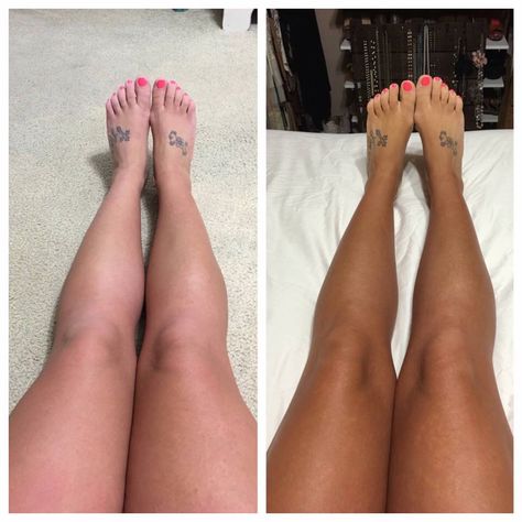 Holy tan legs, ladies!! Still waiting on my tanner to be delivered. Can't  wait to try it!  Please let me get as dark as this lady!! Guess what??? This is after one application applied before bed. https://www.youniqueproducts.com/longandlovelylashes/account/myparties Tanning Bed Before And After, Tan Before And After, Younique Products, Tanning Tips, Tan Legs, Tanning Bed, Tan Body, Sunless Tanning, Younique Makeup