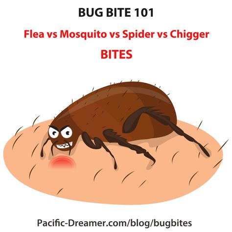 You may wake up and find out bug bites all over you, but have no idea who to blame. What exactly bit you? Was it a #flea? A #mosquito? A #Chigger? A #spider? Learn how to identify them in this article Different Bug Bites, Bug Bites Identifying, Bug Bites, Pest Control, Bugs, Wake Up, Bugs And Insects