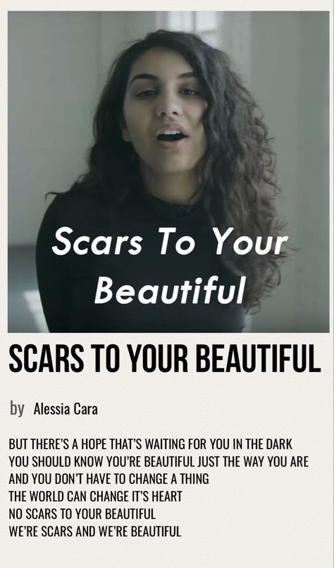 Alessia Cara Scars To Your Beautiful, Scars To Your Beautiful Song, Scars To Your Beautiful, Poster Polaroid, Elastic Heart, Album Posters, Wallpaper 2023, Playlist Spotify, Vintage Music Posters