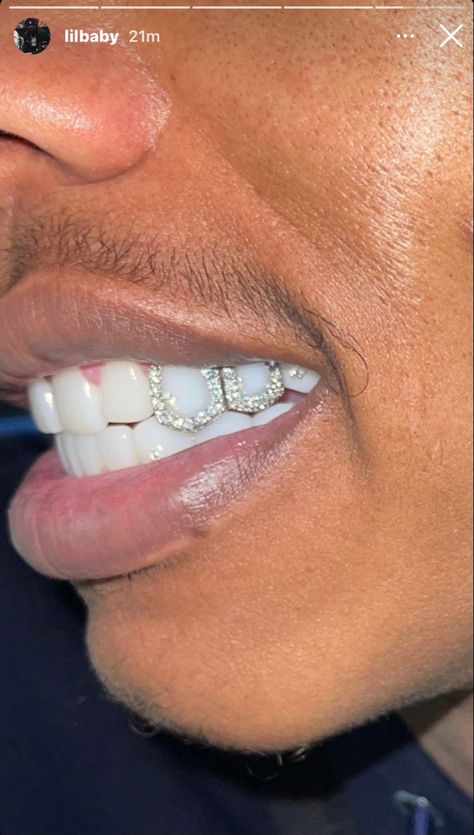 Nas Hip Hop, Girl Grillz, Pretty Teeth, Dental Jewelry, Grillz Teeth, Diamond Grillz, Windows To The Soul, Diamond Teeth, Grills Teeth