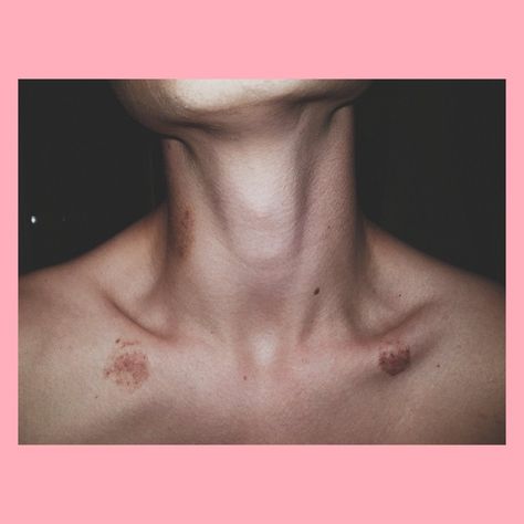 Hicks On Neck Aesthetic, Aesthetics Hickeys, Love Bites Hickey For Boys, Hickey Neck Aesthetique, Love Bites Hickey, 2024 Relationship, Neck Full Of Hickeys, Hicks On Neck, Hickies Neck Aesthetic