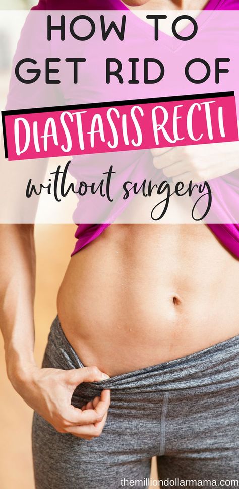 How to get rid of diastasis recti post pregnancy. This post is awesome for how to get a flat stomach, lose the mummy tummy and heal abdominal separation postpartum without having to have surgery. #mummytummy #postpartum #diastasisrecti Exercises For Diastasis Recti, Corrective Exercises, Mummy Tummy, Get A Flat Stomach, Burn Stomach Fat, Tummy Workout, Diastasis Recti, The Mummy, Stomach Fat