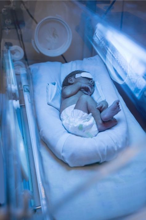 Research shows that every 6 of 10 newborns develop jaundice. It is an easily treatable condition. Here are the signs to look for in your newborn baby Jaundice Newborn Remedies, Baby Jaundice, Jaundice Newborn, Nurse Job, Baby On A Budget, Birth Center, Nicu Nurse, Pinterest Group, Nursing Jobs