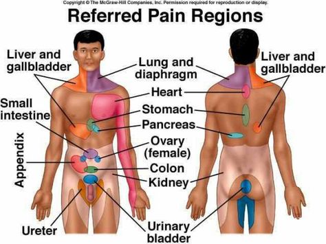 Referred pain chart Referred Pain, Health Chart, Psoas Muscle, Cupping Therapy, Medical Anatomy, Nursing Notes, Abdominal Pain, Shoulder Pain, Reflexology