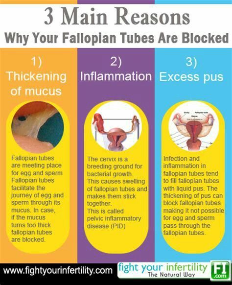 Unblock Fallopian Tubes, Fertility Exercise, Healthy Uterus, Fallopian Tube Blockage, Tubal Reversal, Blocked Fallopian Tubes, Getting Pregnant Tips, Estrogen Hormone, Fertility Doctor