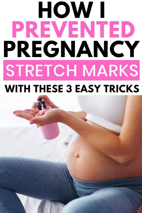 If you are worried about stretch marks during pregnacny, have no fear! These are the exact 3 tips I used to prevent stretch marks. It’s easier than you think!! #pregnancy #pregnancytips #stretchmarksbeforeandafter #babyonboard Stretch Mark Prevention Pregnancy, Exercise While Pregnant, Acne Prone Skin Care, Tips For Oily Skin, Anti Wrinkle Skin Care, Eye Skin Care, Pregnancy Information, Moisturizer For Oily Skin, Anti Aging Tips