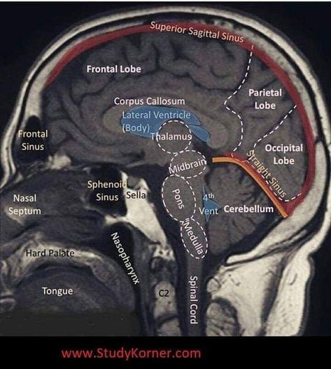 Mri Registry Study Guides, Mri Study Guide, Medical Radiography, Mri Brain, Medical Assistant Student, Radiology Student, Radiology Imaging, Medicine Tips, Basic Anatomy And Physiology