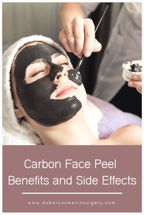 Are you going to get the carbon face peel? You should know the benefits and side-effects before making your decision. Avail our FREE consultation now to clear your concerns! Hollywood Peel, Carbon Facial, Facial Before And After, Carbon Peel, Carbon Laser, Skin Cream Recipes, Facial Benefits, Face Laser, Laser Peel