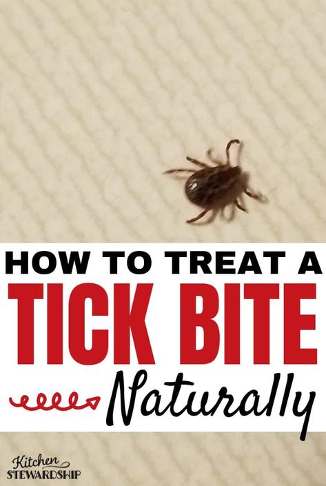 How to Treat a Tick Bite Naturally - What to do After Removing a Tick: Find out how to treat a tick bite naturally, and should you save the tick for testing? Are antibiotics necessary after all tick bites? Tick Removal, Natural Antibiotic, Tick Bite, The Tick, Bug Control, Essential Oils Herbs, Natural Antibiotics, Natural Insect Repellant, Holistic Remedies