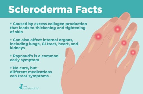 Scleroderma Facts Scleroderma Symptoms, Scleroderma Awareness, Autoimmune Disease Symptoms, Auto Immune, Health Podcast, Gi Tract, Lung Disease, Scar Tissue, Autoimmune Disease