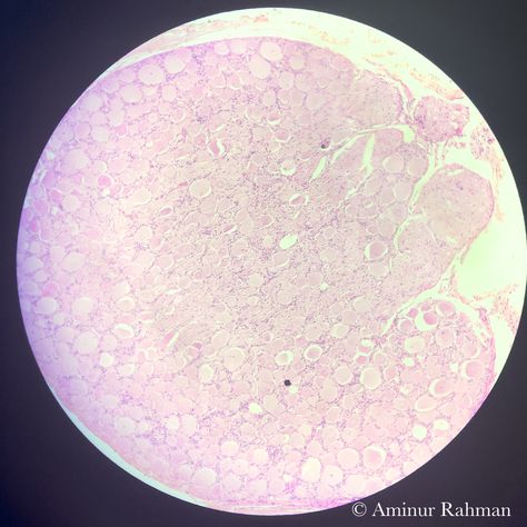 Human Neuron AKA the nerve cell under the microscope 🔬. Subhan Allah the creation of Allah SWT is truly amazing. 🤩. #neuroscience #neurons #nervecell #uniofnottingham Cells Under Microscope, Under Microscope, Nerve Cells, Under The Microscope, The Nerve, Nerve Cell, Neuroscience, Nerve, The Creation