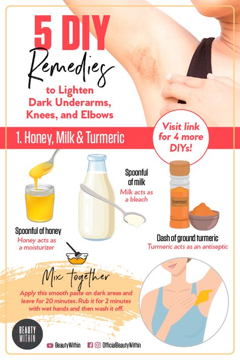 Skin Lightening Diy, Dark Elbows, Underarm Odor, Dark Armpits, Dark Underarms, Diy Remedies, Lighten Skin, Today Is The Day, Skin Care Remedies