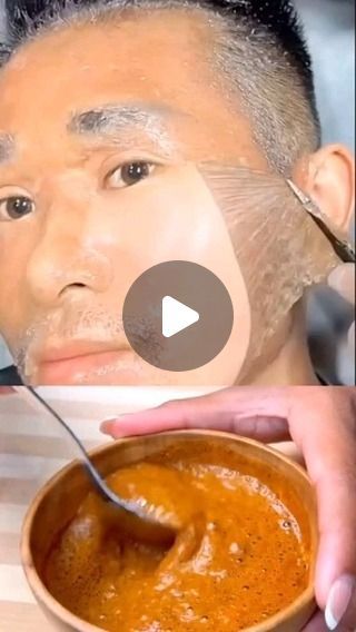 Pigmentation On Face, Cleansing Skincare, Dark Spot Remover For Face, Skin And Makeup, Natural Recipes, Dark Spots On Face, Brown Spots On Face, Dark Spots On Skin, Spots On Face