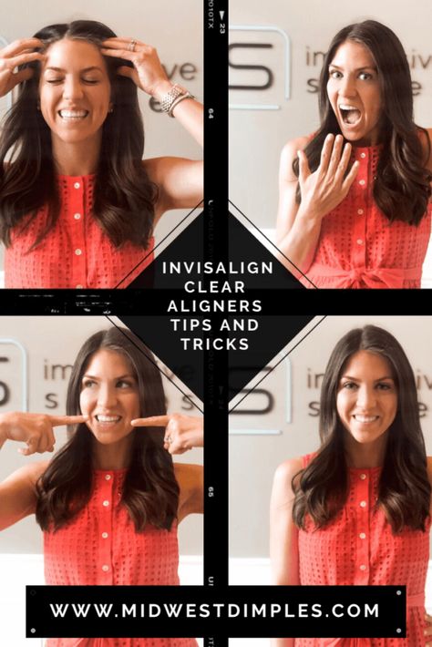 Invisalign Tips And Tricks, Invisalign Before And After, Overbite Before And After, Invisalign Attachments, Invisalign Hacks, Invisalign Tips, Clear Teeth, Braces Journey, Teeth Aligners