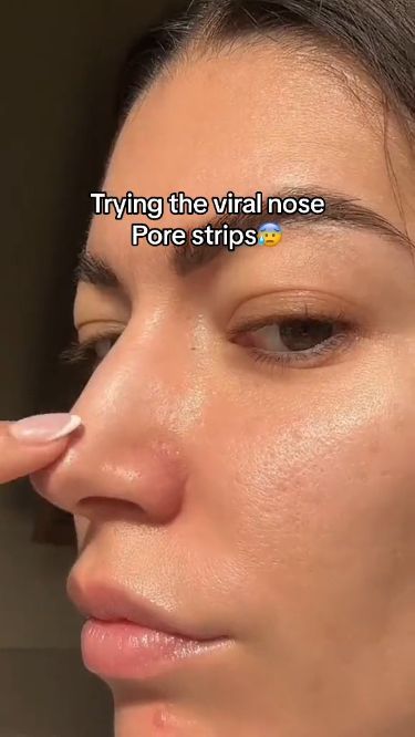 GET THIS FACE MASK LINK IN BIO ☝️ Whiteheads Removal, Skin Blackheads, Get Rid Of Pores, Nose Pore Strips, Sebaceous Filaments, Remove Blackheads From Nose, Nose Pores, Blackheads On Nose, Pore Strips