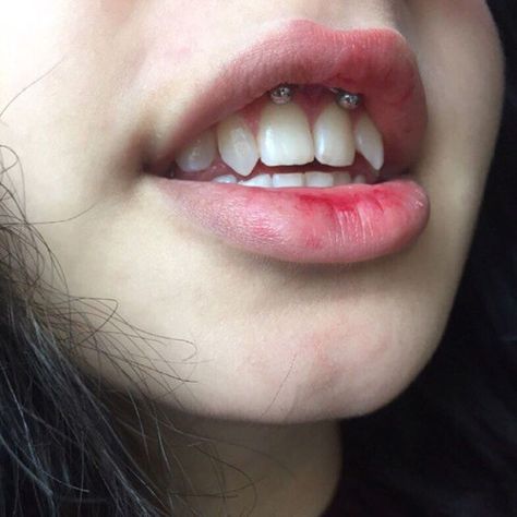 pinterest: makemwhyo Labret Vertical, Alissa Salls, Smiley Piercing, Vampire Teeth, Cool Piercings, Cute Piercings, Body Piercings, Body Modifications, Piercing Tattoo