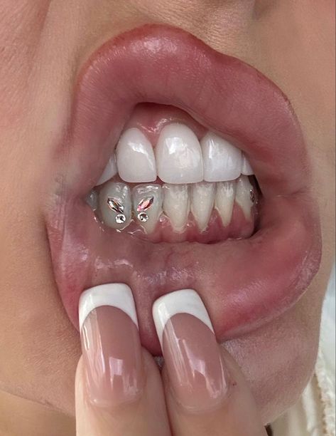 Teeth Gems Butterfly, Bottom Teeth Gems, Tooth Gems Butterfly, Bottom Tooth Gem, Tooth Gems Bottom Teeth, Teeth Piercing, Butterfly Tooth Gem, Teeth Jewels, Grillz Silver