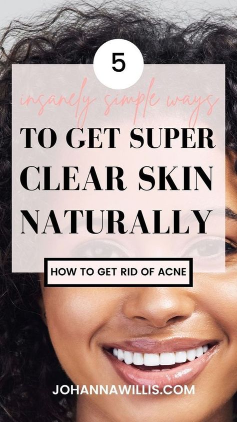 Get Clear Skin Naturally, Get Rid Of Acne Fast, Whitening Face Mask, Beauty Without Makeup, Clear Skin Naturally, Fair Face, Remedies For Glowing Skin, Get Clear Skin, Fast 5