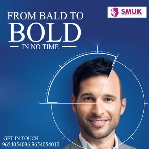 From Bald to Bold in No Time! For More Details Visit: - www.smuk.in  #SMUK #SkinCare #HairTreatment #HairCare #HairBonding #HairFallSolution Hair Transplant Creative Ads, Hair Fall Solution, Visual Reference, Hair Clinic, Art Photography Portrait, Bald Hair, Hair Png, Hair Replacement, Office Set