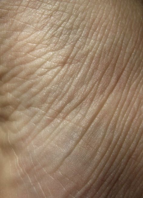 Free Texture Tuesday: Skin Flesh Texture, Wrinkles Photography, Body Imperfections, Human Skin Texture, Texture Skin, Human Photography, Skin Wrinkles, Skin Details, Texture Drawing