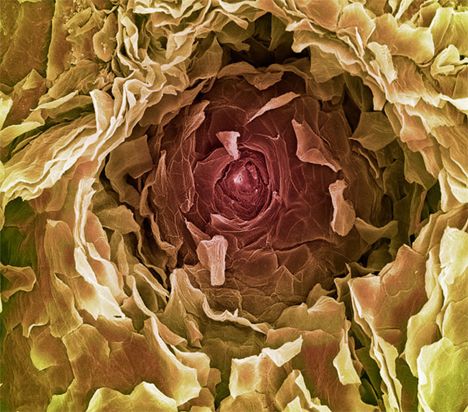 What do you see in this image – a head of lettuce? The inside of a rose? The reality is far less romantic, but that makes it all the more fascinating. It’s a SEM (Scanning Electron Micrograph) of a human sweat pore, opening onto the surface of human skin. Inside Human Body, Electron Microscope Images, Scanning Electron Microscope, Scanning Electron Micrograph, Microscopic Photography, Micro Photography, Elliott Erwitt, Microscopic Images, Electron Microscope