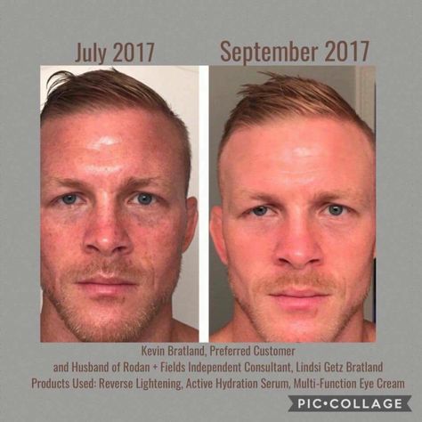 Real men take care of their skin!  But seriously, their skin is just as important - Plus, guys don't just cover it up with make up, they give it to us straight ;) Haha!  Kevin used the stronger Reverse Lightening with Hydroquinone to really tackle those stubborn dark marks & sun damage. His results speak to the quality and efficacy of our products.  If your wondering if it “actually” could work for you? Well, you can try it for 60 days & see what you think! Personally have LOVED the Reverse Ligh Multifunction Eye Cream, Rodan Fields Skin Care, Field Marketing, Rodan And Fields Reverse, Life Changing Skincare, Rodan And Fields, Mens Skin Care, Aging Skin Care, Skin Tightening