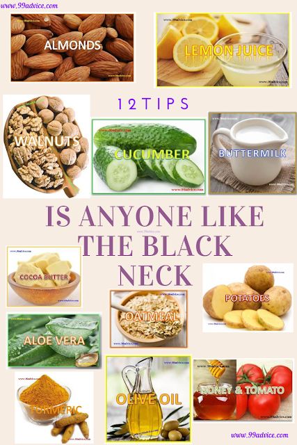 Neck Blackness Removal Tips, Neck Blackness Removal, Black Neck Remedies, Dark Neck Remedies, Aloe Vera Toner, Black Fingers, Butter Potatoes, Natural Skin Care Ingredients, Dead Skin Removal