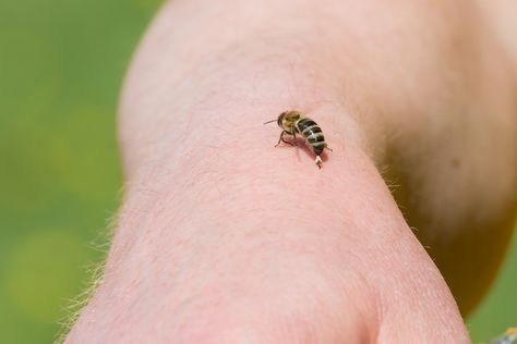 Bees aren't just great at pollinating and making honey. Turns out they make great guinea pigs too. Check out these quirky scientific studies performed on bees! http://modernfarmer.com/2016/06/bee-studies/ Treating Bee Stings, Remedies For Bee Stings, Making Honey, Types Of Bees, Modern Farmer, Difficulty Breathing, Bee Venom, Doctor On Call, Bee Sting