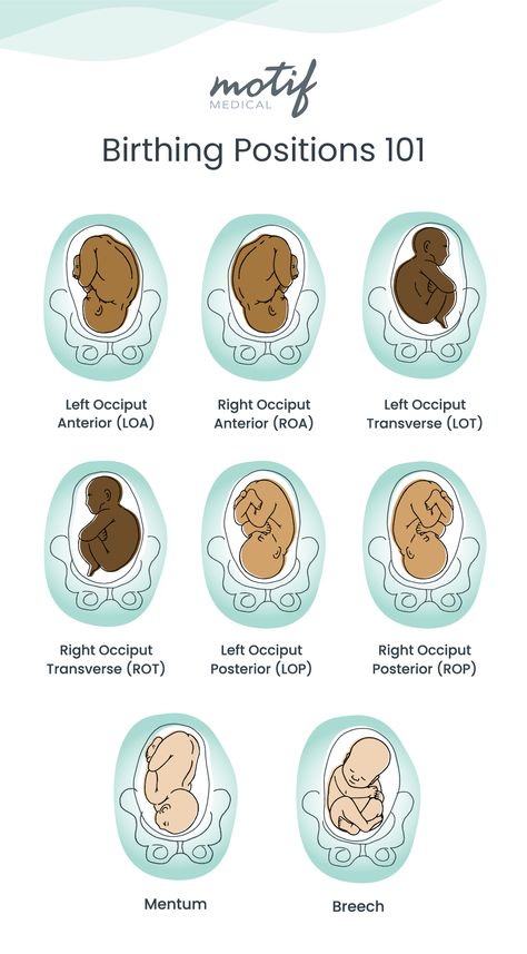 Discover and learn about optimal birthing positions with our midwife in the latest blog! 🤰 Get a FREE birthing chart and valuable tips on locating your baby in your body. Link in bio to learn more about birthing positions before labor. #pregnancytips #motifmedical #labortips #babypositions Birth Tips Labour, Birth Assistant, Labour Positions, Birthing Positions, Birth Positions, Birthing Plan, Labor Tips, Birth Prep, Labor Positions