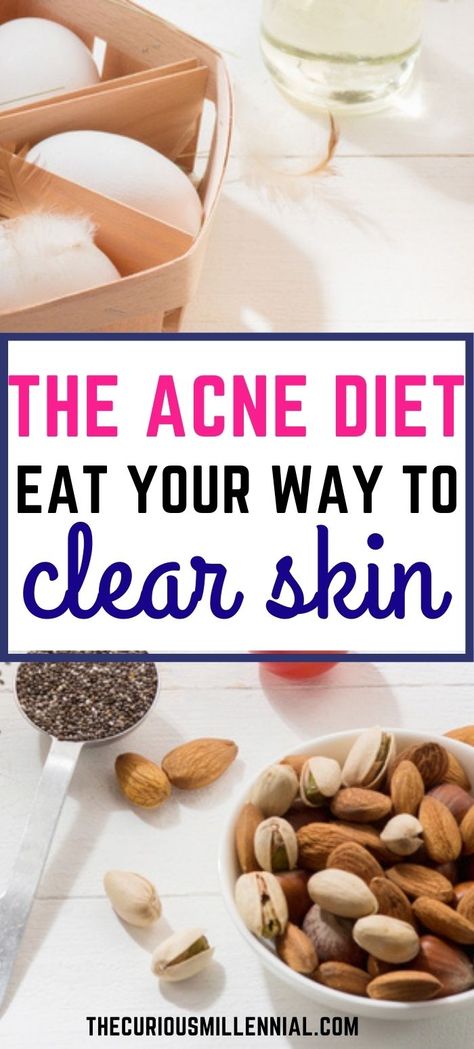 Foods To Eat To Clear Acne, Foods For Acne Free Skin, Acne Elimination Diet, Food For Acne Prone Skin, Meals For Acne Prone Skin, Food For Clear Skin Acne, Diet For Acne Prone Skin, Acne Clearing Foods, Acne Free Diet