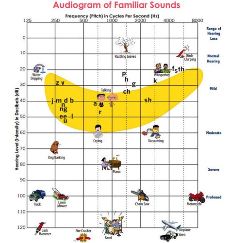 Pediatric | Audiology / Otolaryngology | Head and Neck Surgery Audiology Student, Speech Therapy Tools, Slp Materials, Deaf Education, Language Therapy Activities, Slp Activities, Slp Resources, School Slp, Hearing Health