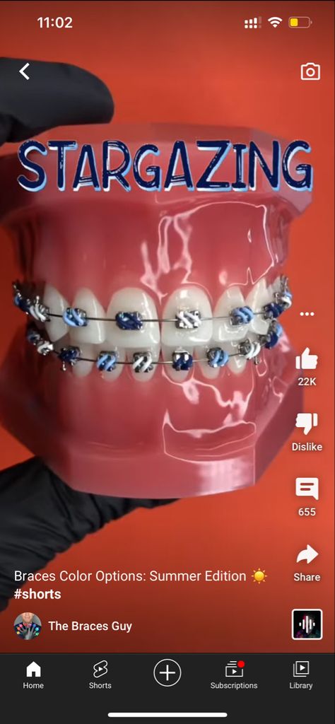 Braces Patterns, Invisalign Tips, Dental Braces Colors, Cute Braces Colors, Braces Tips, Getting Braces, Cute Braces, Brace Face, Candy Design