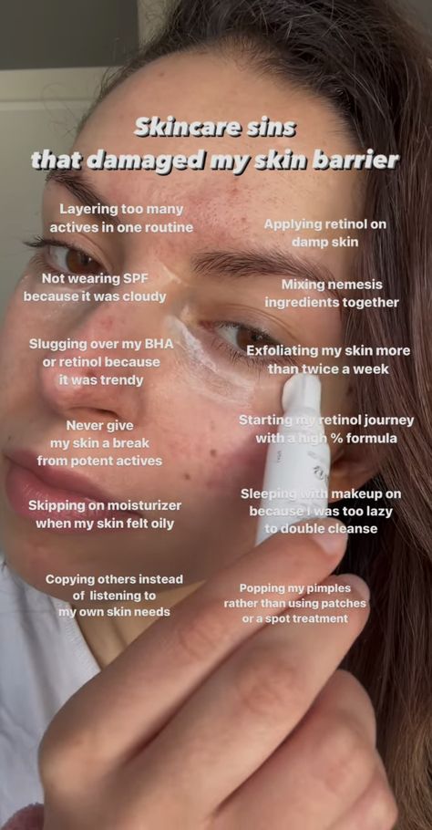 Healing Acne, Skin Advice, Skin Care Guide, Acne Skincare, Face Care Routine, Serious Skin Care, Good Skin Tips, Beauty Tips For Glowing Skin, Skin Care Spa