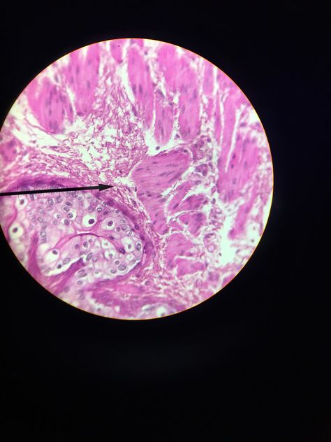 Transitional epithelium looks like it is composed of simple squamous and simple cuboial cells but it has bumps in the top layer. This allows for waterproofing and stretching  In this tissue cystitis can occur Epithelium Tissue, Transitional Epithelium, Histology Slides, Stretching, The Top, Slides, Celestial Bodies, Quick Saves