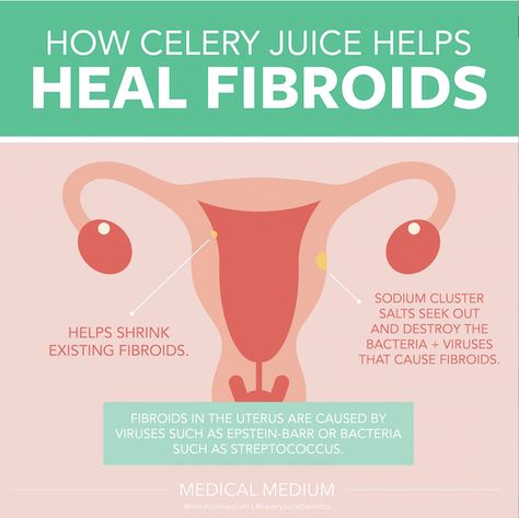 How Celery Juice Helps Heal Fibroids Uterine Fibroid Juice, Fibroid Healing, Cysts Remedies, Enlarged Uterus, Fibroid Diet, Fibroid Uterus, Fibroid Tumors, Heavy Periods, Chronic Constipation