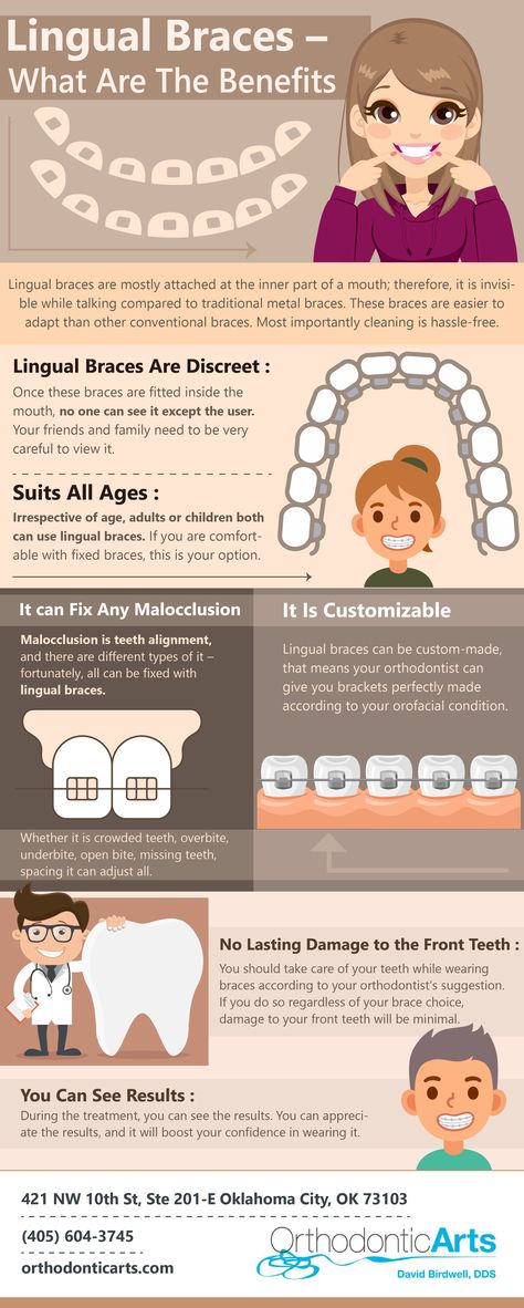 Braces Before And After, Fixed Braces, Lingual Braces, Dental Assistant Study, Teeth Braces, Metal Braces, Data Charts, Information Graphics, Dental Assistant