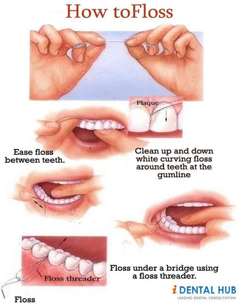 Dental Flossing, it is such a common thing but still many people donot floss thier teeth correctly. there are different kinds of dental flossing available im market. Using correct techinque to floss teeth is very important for oral hygiene. Dental Flossing, Flossing Teeth, Kedokteran Gigi, Dental Hygiene School, Dental Facts, Emergency Dentist, Dental Products, Teeth Health, Dental Surgery