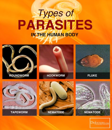 What Type of Parasites do You Have? - DrJockers.com Homestead Apothecary, Parasite Cleanse Diet, Backyard Bed, Parasites Symptoms, Parasitic Worms, Gut Issues, Intestinal Parasites, Parasite Cleanse, Helpful Advice